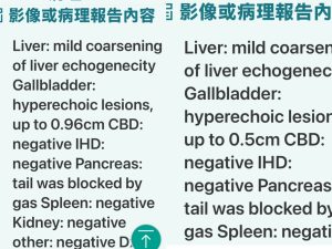 gallbladder polyp tcmtreatment